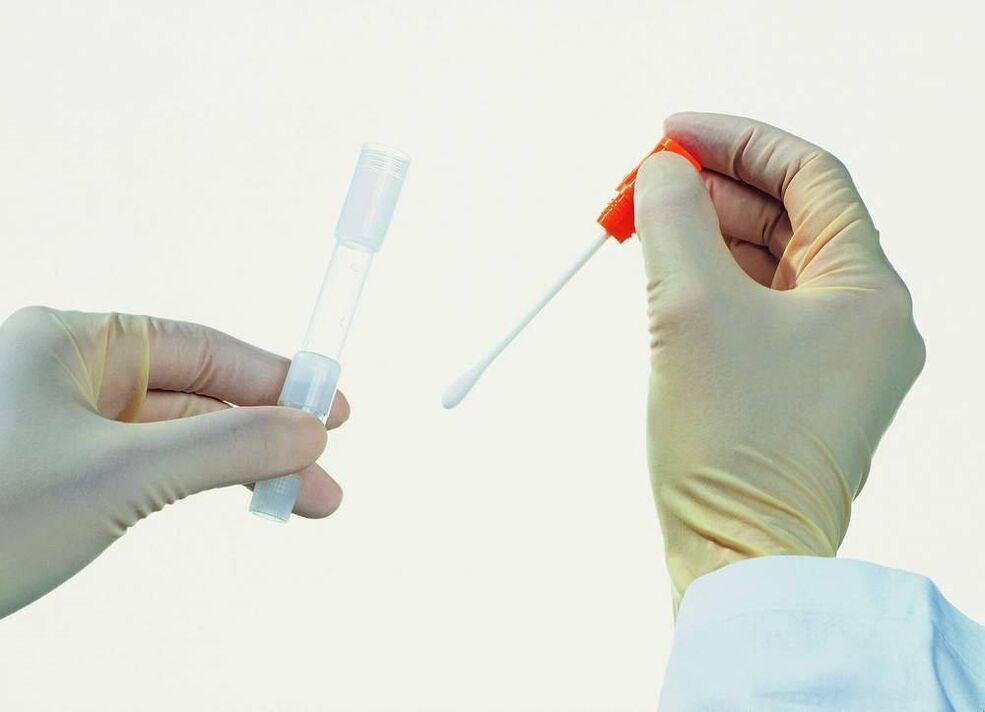 Coleta de exames para detectar prostatite crônica