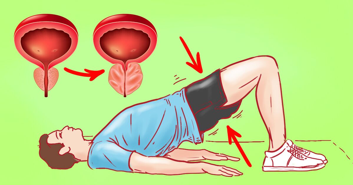 Exercícios terapêuticos para prostatite crônica